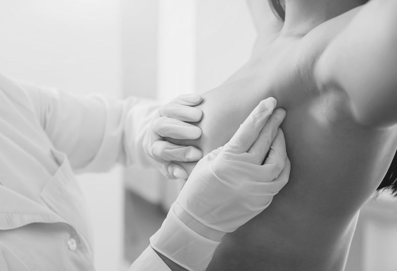 Jede achte Frau hat Brustkrebs – Mediziner werben für Vorsorge